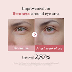[Subscr.] PDRN Pink Peptide Eye Cream